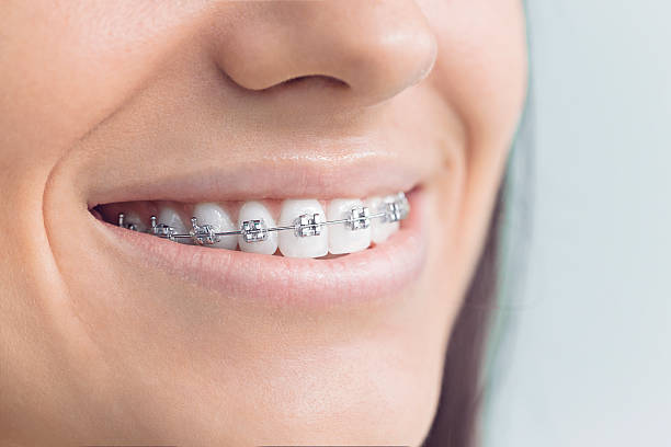 Best Traditional Braces  in Oakland, TN